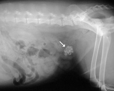 bladder